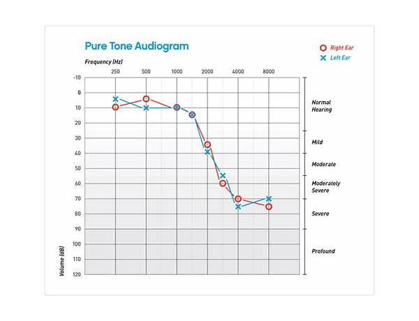 Exclusive License: Audiogram, musical term